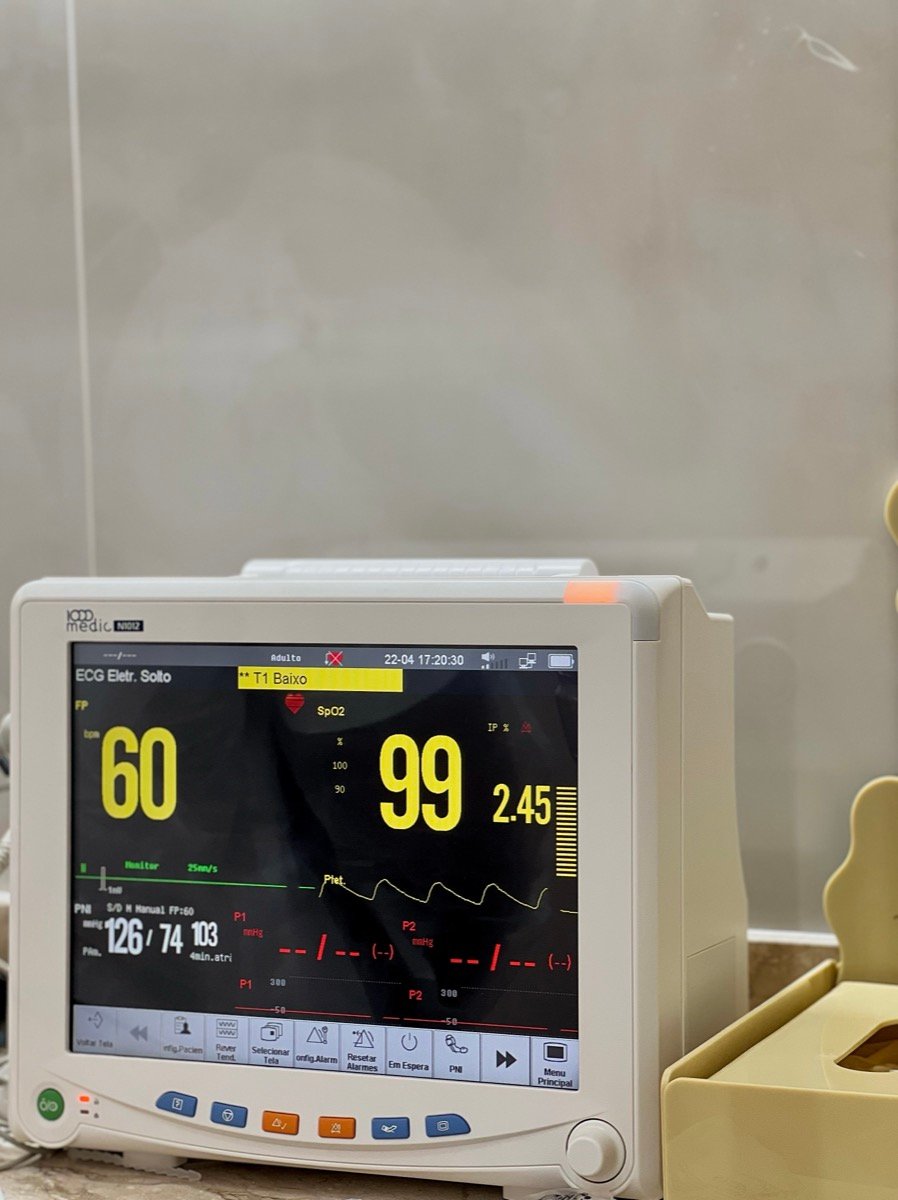 Monitor de sinais vitais durante procedimento com sedação